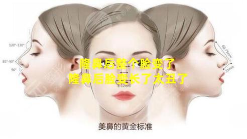 隆鼻后整个脸变了 隆鼻后脸变长了太丑了
